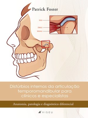 cover image of Distúrbios internos da articulação temporomandibular para clínicos e especialistas